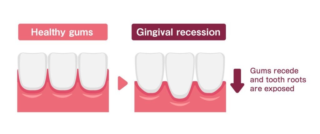 Illustration comparing traditional dental impressions with digital 3D scanning used during orthodontic assessment.