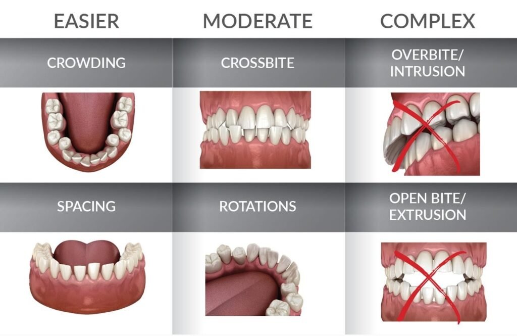 Digital orthodontic images showing teeth alignment and treatment progress