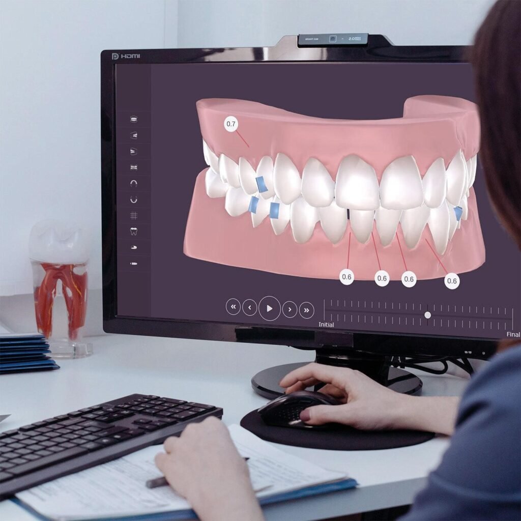 Computer displaying a three-dimensional digital model of teeth for orthodontic treatment planning.