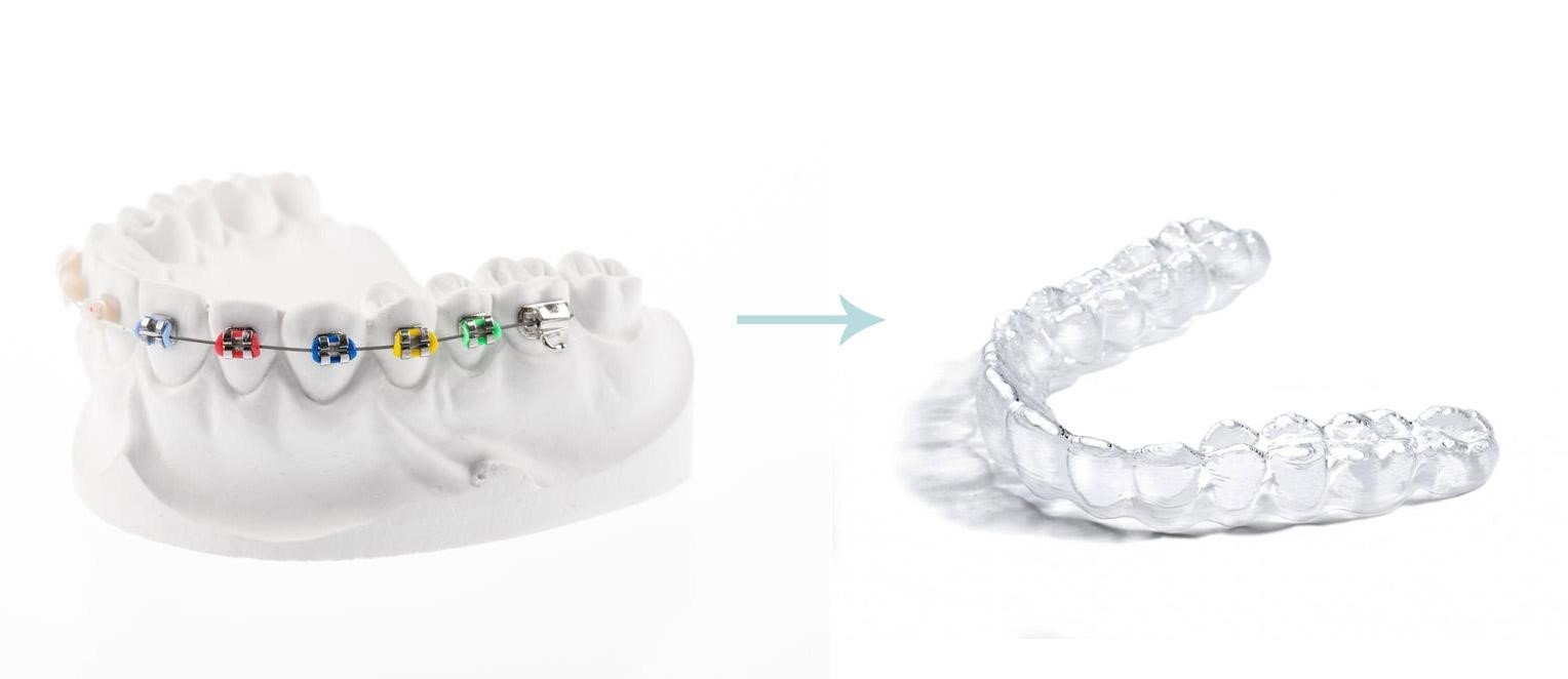 Clear dental aligners used for orthodontic treatment
