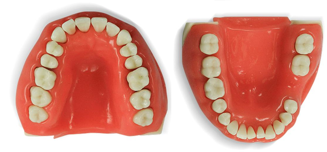 Upper and lower dental models illustrating dental arch shape and tooth position.