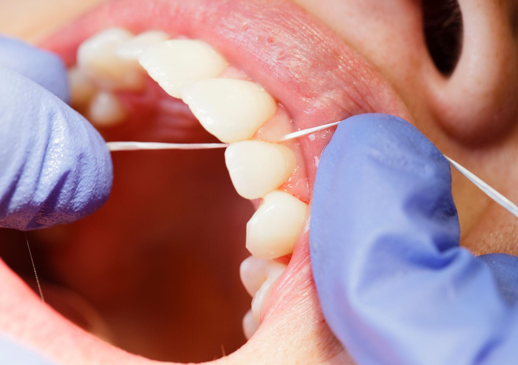 Dental examination of teeth and tooth alignment